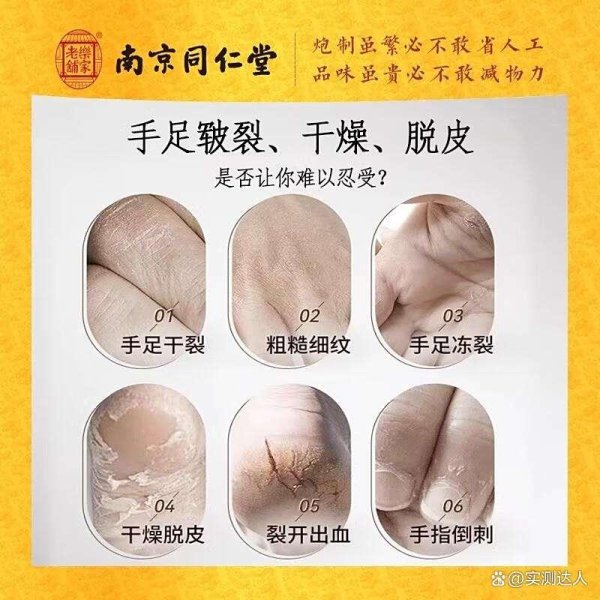 开云体育咱们将详备先容几款值得关注的护足霜品牌-kaiyun体育官方网站全站入口